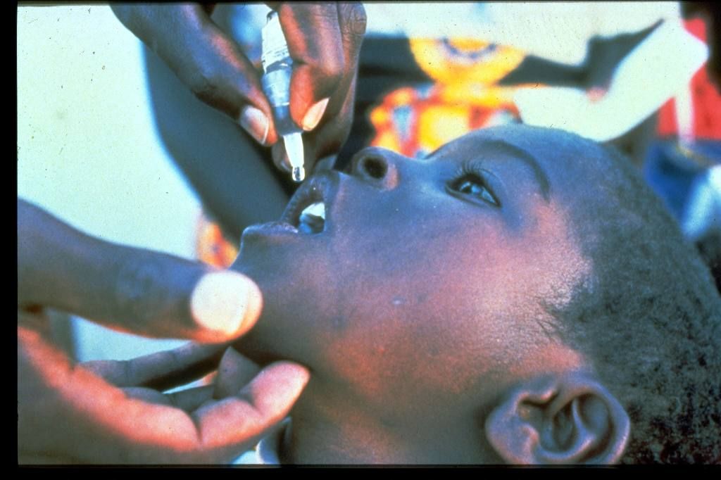 Polio vaccine being given to a young child. Polio affects the young and most vulnerable people.